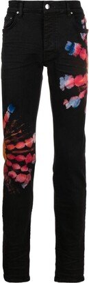 Tie-Dye Print Skinny Jeans