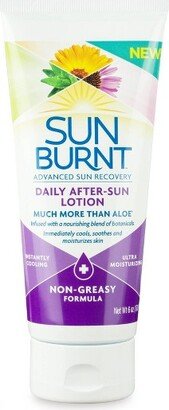 SunBurnt Advanced After Sun Lotion - 6oz