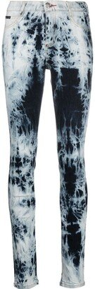 High-Waisted Acid-Wash Jeggings