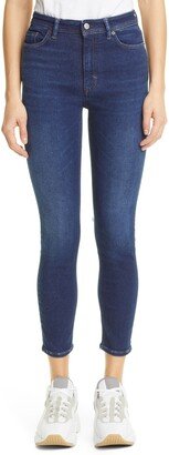 Peg Skinny Ankle Jeans